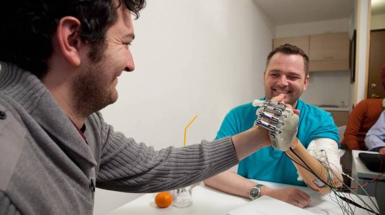 An Artificial Arm Gives One Man The Chance To Feel Again