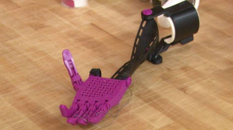 This prosthetic is made from a series of parts made with a 3D printer. - Steve Burns/WTIU