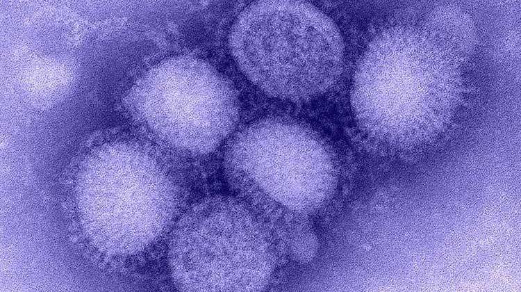 Image of the H1N1 influenza virus. - CDC Influenza Laboratory