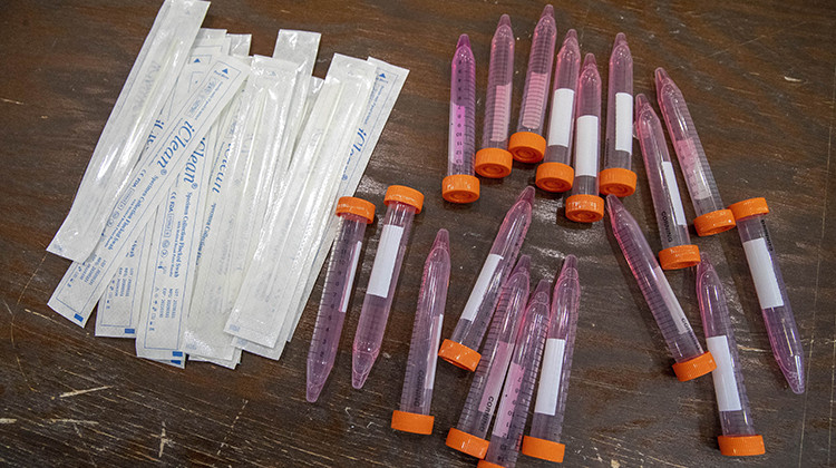 FILE- In this May 13, 2020 file photo, test swabs and specimen tubes sit on a table at a COVID-19 testing site. - AP Photo/Mary Altaffer