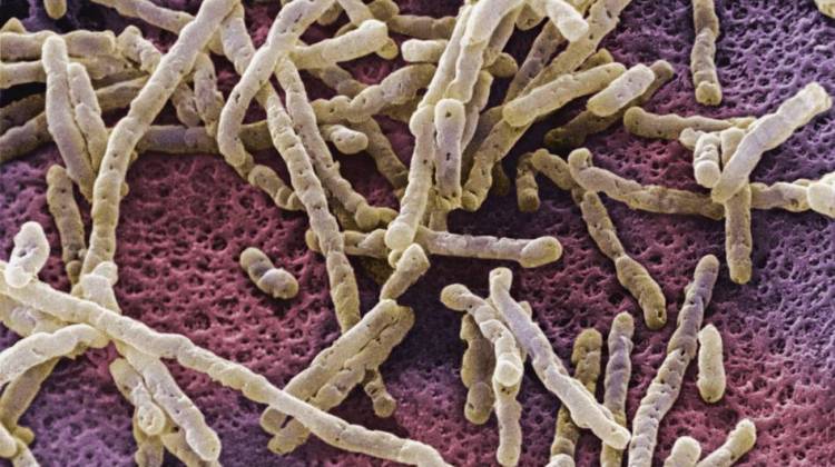 Infections With Dangerous Gut Microbe Still On The Rise