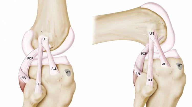 Surgeons Discover Quirky Knee Ligament All Over Again