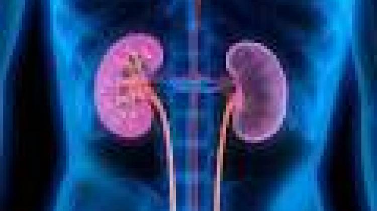 Desensitization Process Helps Kidney Transplant Patients