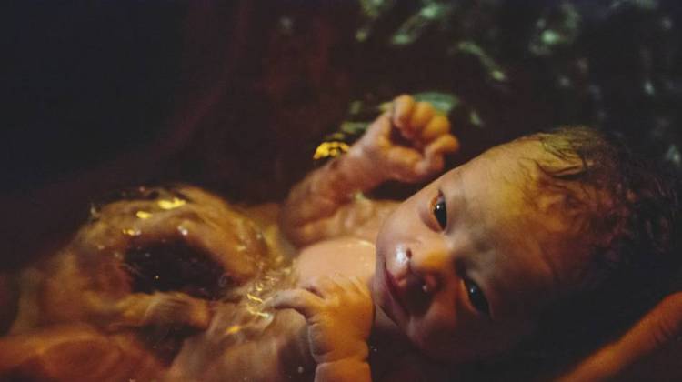 Don't Birth That Baby In A Tub, Doctors Say, But Midwives Disagree