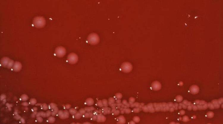 Shigella boydii bacteria on a blood agar plate. - CDC