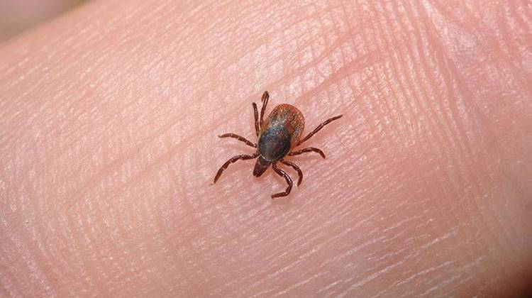 Indiana Residents Warned To Be Alert For Ticks