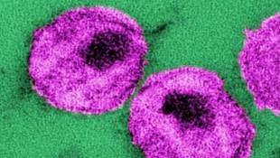 AIDS Scientists Encouraged By Antibodies That Hit Monkey Virus