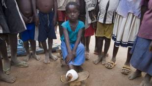 Slaying 'Little Dragons:' Guinea Worm Moves Toward Eradication