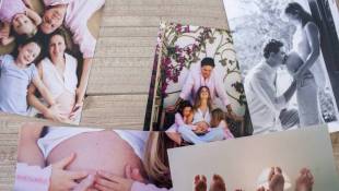 Pregnancy Hormone May Reduce Multiple Sclerosis Symptoms