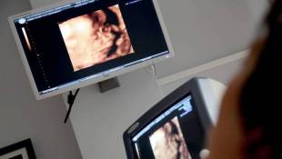 Proposal Would Mandate Ultrasound Before Abortion