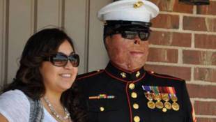 Severely Burned Marine Finds Strength In Nascent Marriage