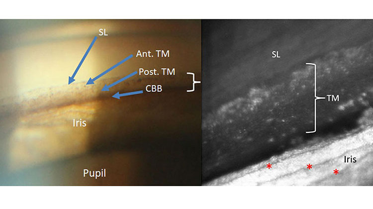 The left image shows what can usually be seen in a doctor's office. The right image shows a portion of the same part of the eye in much greater detail using methods developed at IU. - Courtesy the Indiana University School of Optometry