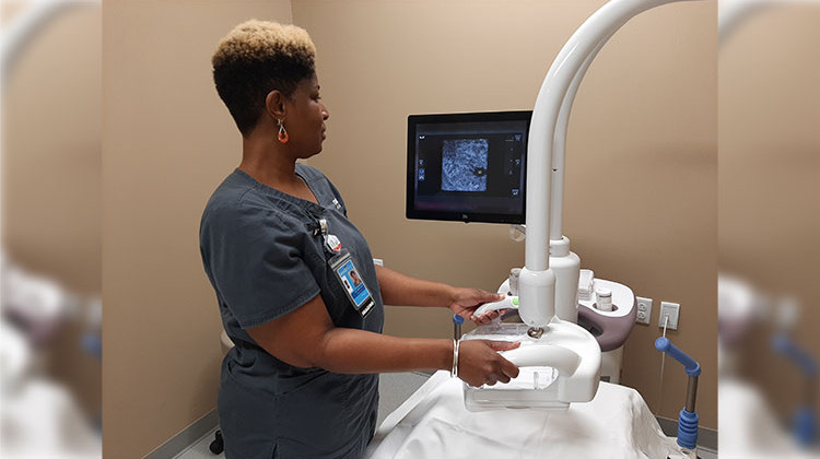 Eskenazi Health's Automated Breast Ultrasound (ABUS) Tool  could help reduce the misdiagnosis of breast cancer.  - Provided by Eskenazi Health