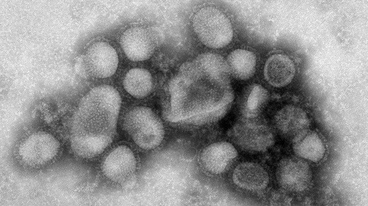 Negative stain EM image of the swine influenza. - C. S. Goldsmith and A. Balish/CDC
