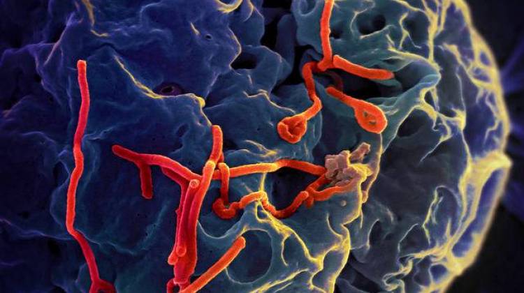 Indianapolis officials are assuring citizens they are prepared to deal with the Ebola virus. - National Institute of Allergy and Infectious Diseases/Flickr