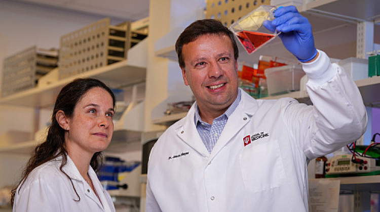Indiana University will be home to one of two national centers studying Alzheimer’s disease using human brain models - Photo Courtesy of Tim Yates, IU School of Medicine