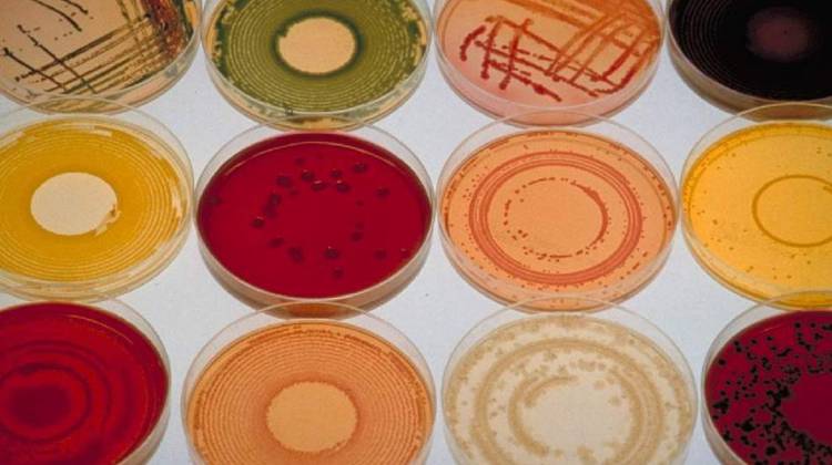 Mix Of Gut Microbes May Play Role In Crohn's Disease