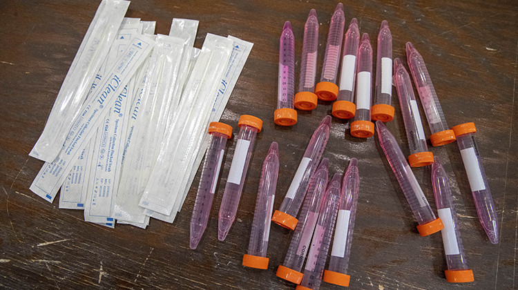 FILE- In this May 13, 2020 file photo, test swabs and specimen tubes sit on a table at a COVID-19 testing site. - AP Photo/Mary Altaffer
