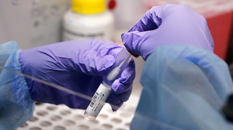 FILE - A biomedical engineering graduate student, holds a swab and specimen vial in the new COVID-19, on-campus testing lab, Thursday, July 23, 2020, at Boston University in Boston. The United States has improved its surveillance system for tracking new coronavirus variants such as omicron, boosting its capacity by tens of thousands of samples since early 2021. - AP Photo/Charles Krupa, File