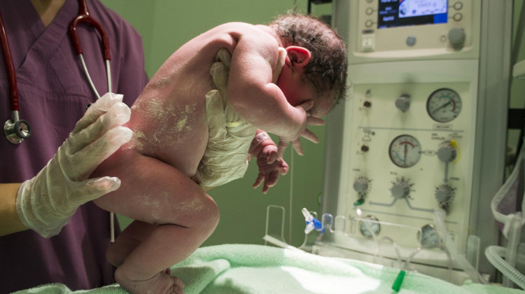 Hoosier Health Experts Say There's Still Work To Be Done Addressing Infant Mortality Rate