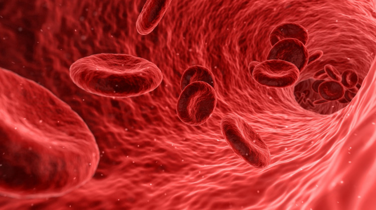 Indiana Center Helped Bring New Hemophilia Treatment To Light - Photo by Arek Socha is licensed under CC 0. https://pixabay.com/en/blood-cells-red-medical-medicine-1813410/ - Agency: Courtesy photo - Agency: Courtesy photo