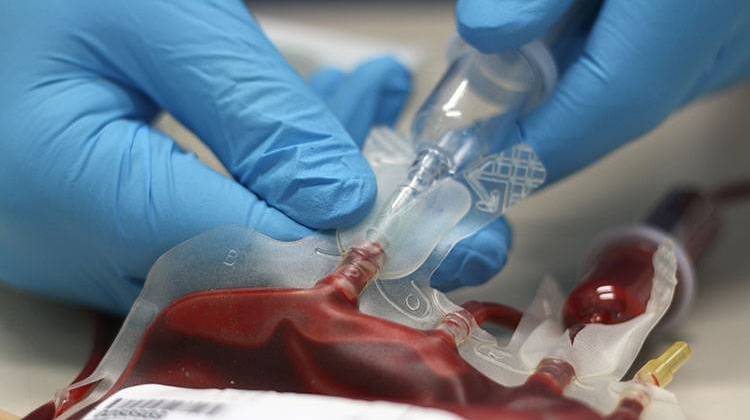 Critically Low Blood Supply Levels Concern Some Providers