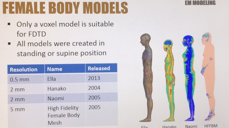 A lack of female computer models has hindered MRI breast cancer research.