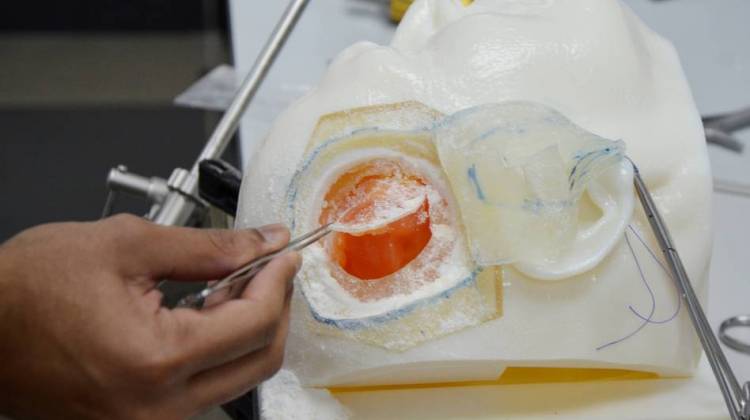 Novice Neurosurgeons Train On Brains Printed In 3-D  