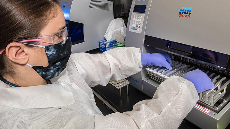 A Centers for Disease Control and Prevention scientist loads samples into an automated instrument to test for SARS-CoV-2, the virus that causes COVID-19. - James Gathany/CDC