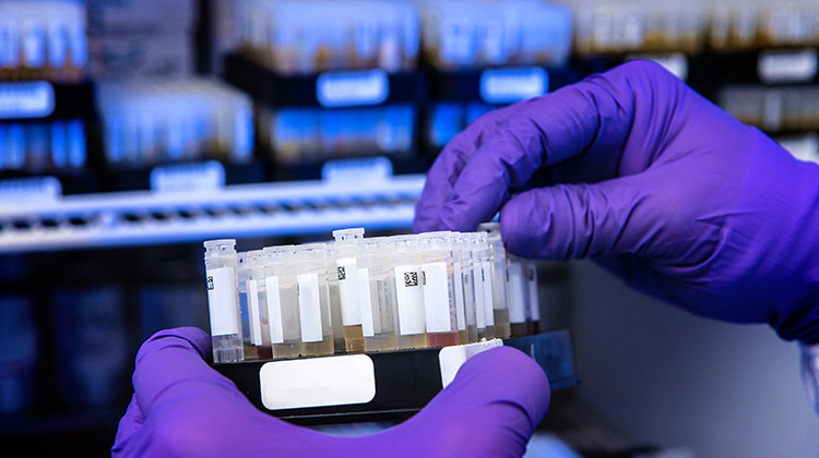 A Centers for Disease Control and Prevention (CDC) scientist prepares patients' samples for SARS-CoV-2 antibody testing. - CDC/ James Gathany