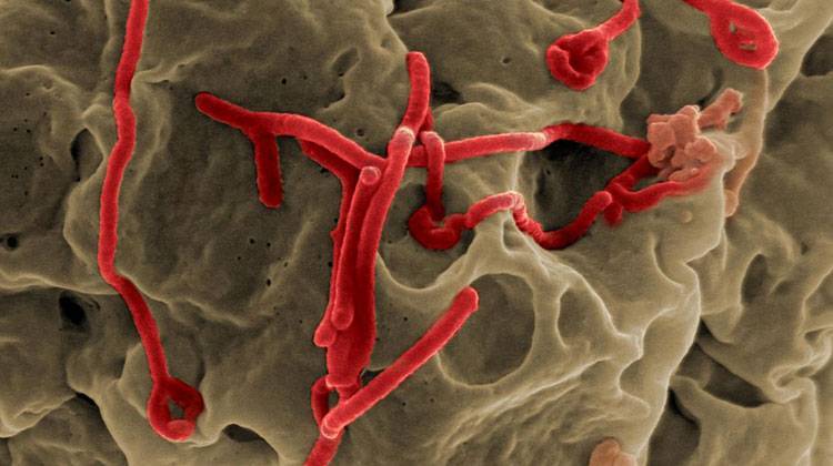 Scanning electron micrograph of Ebola virus budding from the surface of a Vero cell. - NIAID