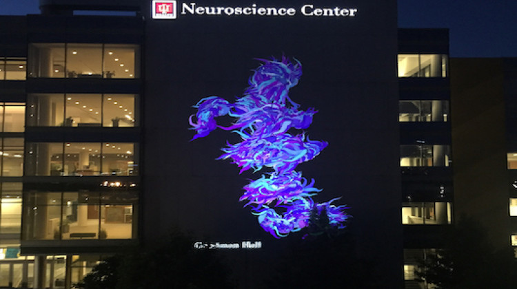 Indiana scientists and artists have teamed up to help ALS patients create art