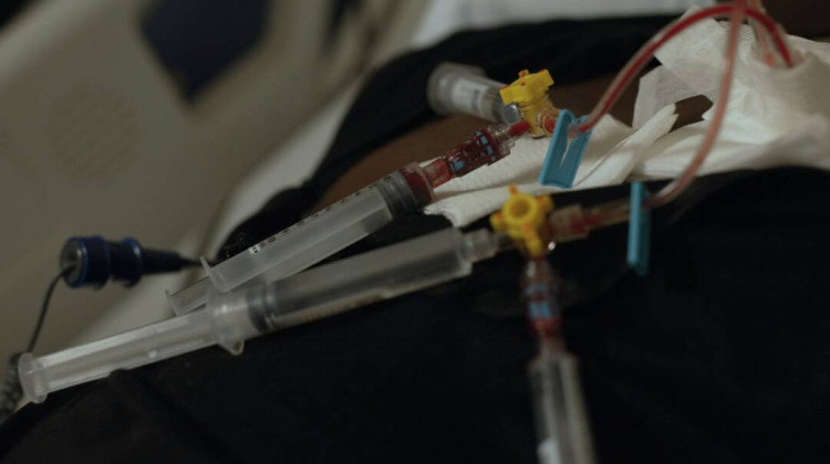 Sickle cell experts worry as CDC's Division of Blood Disorders staff put on leave