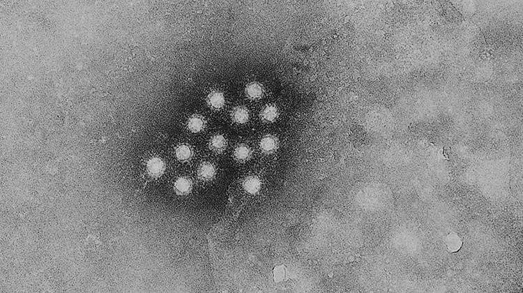 Electron micrograph of a small cluster of the ribonucleic acid hepatitis A virus. - Centers for Disease Control and Prevention/Public Health Image Library