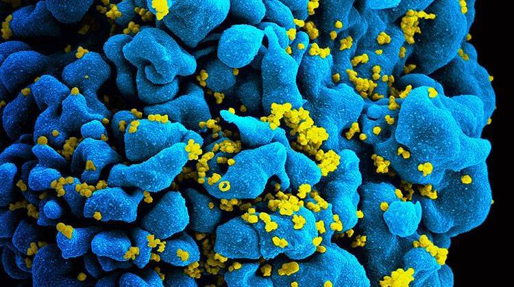 Indiana's HIV Outbreak Continues To Grow