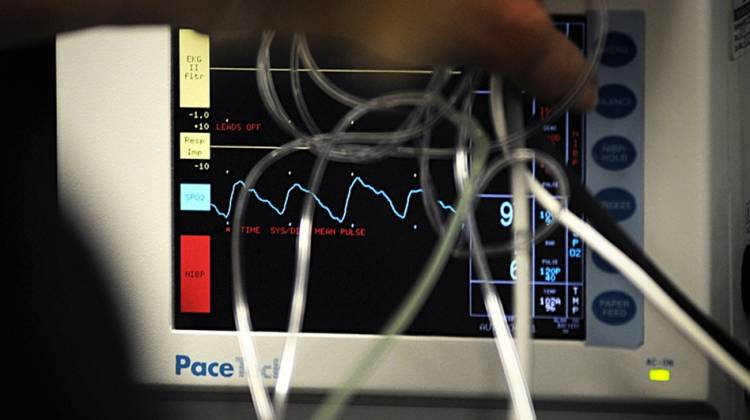 Delirium In The ICU May Pose Ongoing Risk Of Thinking Problems