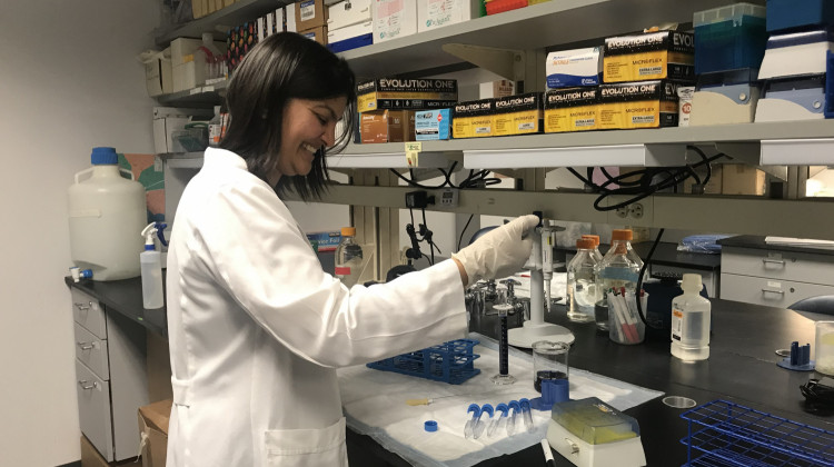 Ushashi Dadwal, a postdoctoral fellow, works in the Kacena Lab on IUPUI's campus. - Emily Cox/WFYI