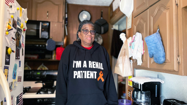 Why some hospitals have stopped using race-based calculations for kidney disease