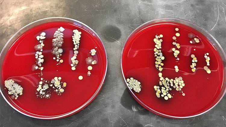 Reporter Jill Sheridan participated in the experiment. The petri dish on the left is her before, and the dish on the right is her after. - Photo courtesy IU Health pathology lab