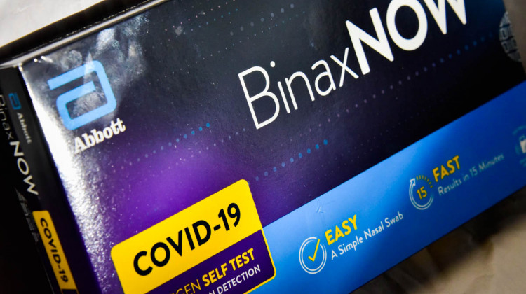 State Health Commissioner Dr. Kris Box said the individual testing and positivity rates change was largely driven by the availability of at-home tests. Indiana does not require those tests be reported. - Justin Hicks/IPB News