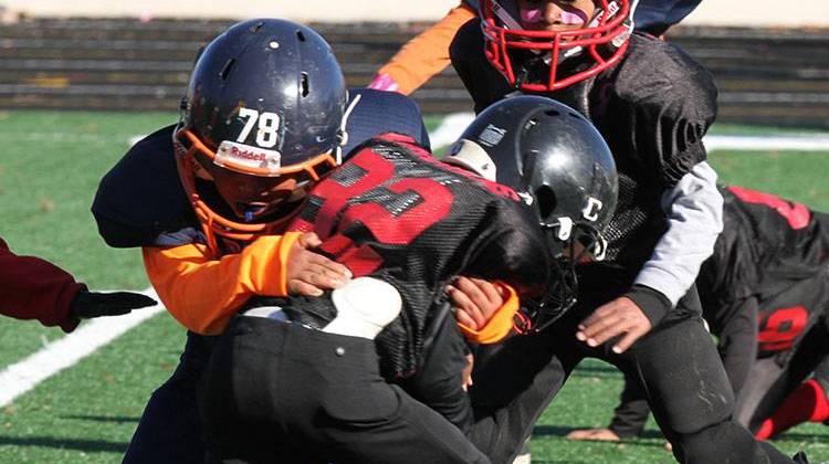 NFL Alumni Indianapolis Chapter Gives $35K For Concussion Efforts