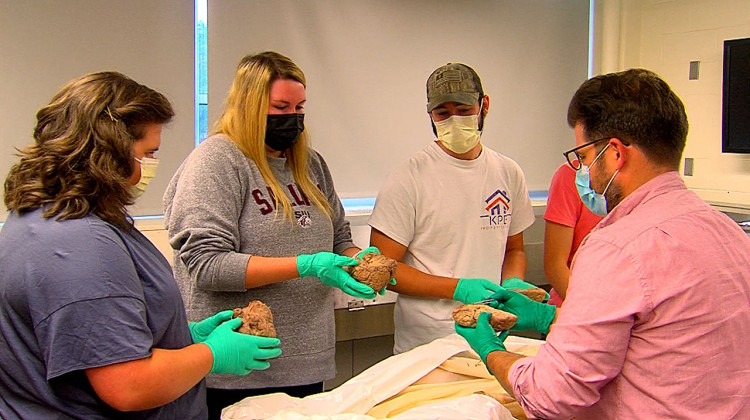 Medical students gather around their anatomy professor Jonathan Krimsier (right) as he talks about the different parts of the human brain. The students are enrolled in the Lincoln Scholars program at the SIU School of Medicine in Carbondale, Illinois. - (Benjy Jeffords/WSIU)