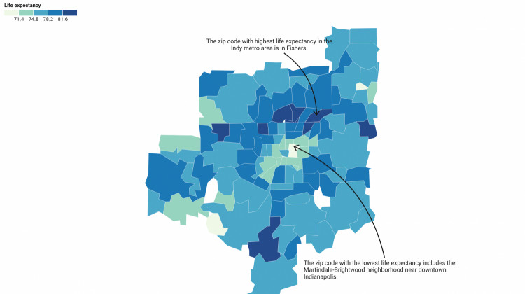 New research shows the life expectancy gap is nearly 17 years between the longest-living and shortest-living zip codes in the Indy metro area.