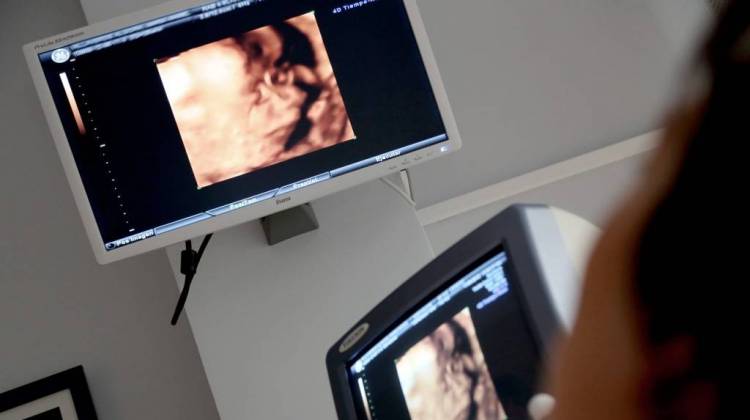 Proposal Would Mandate Ultrasound Before Abortion