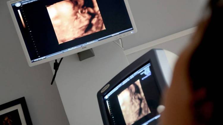 Attorney General Appeals Ruling Blocking Ultrasound Law
