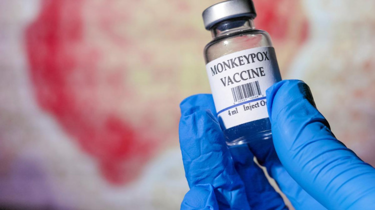 As monkeypox spreads, is Indiana prepared for an outbreak?
