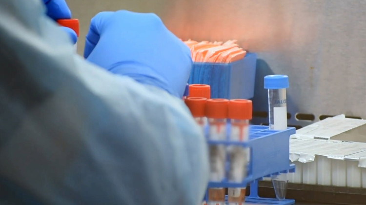 A member of IU Health's monkeypox testing lab works with vials. Since June, more than 260 cases of monkeypox have been reported in Indiana.  - Courtesy of IU Health