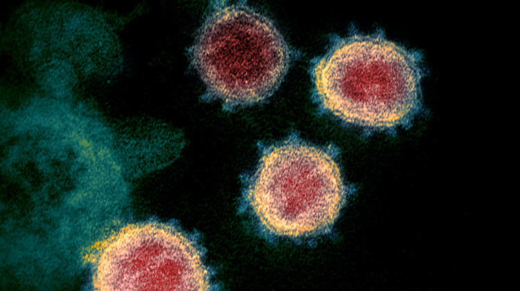 This transmission electron microscope image of SARS-CoV-2 isolated from a patient in the U.S. - NIAID-RML/Wikimedia Commons