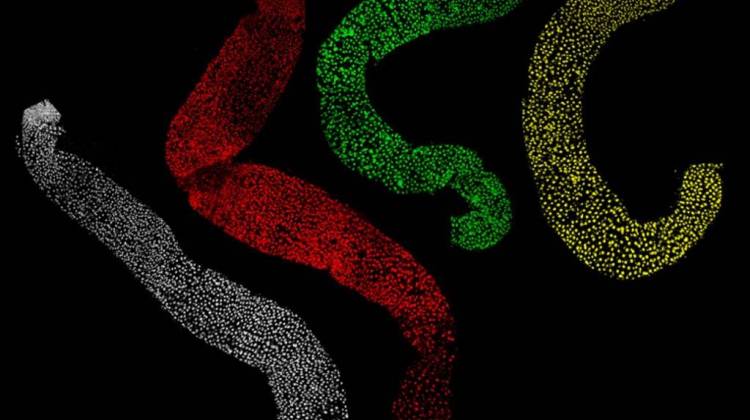 This image shows four intestinal samples from fruit flies. The normal-sized intestine appears in white. A larger-than-average intestine with a mutated FMR1 gene appears in red. A smaller-than-average intestine with a mutated LIN-28 gene appears in green. A sample from a fly with both mutations appears in yellow. - Photo courtesy of Arthur Luhur/Indiana University