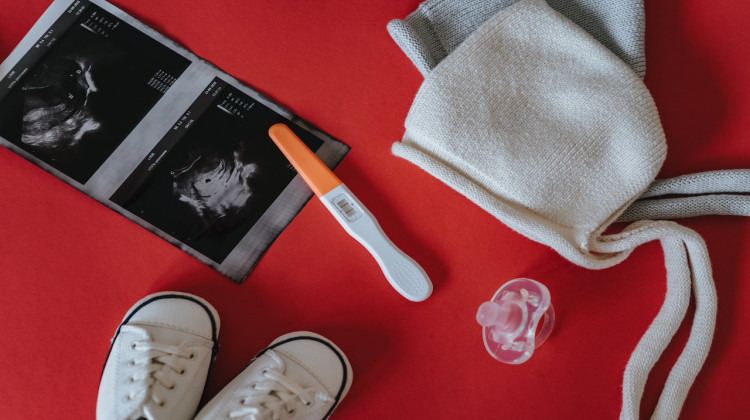 One in 175 pregnancies ends in stillbirth and about 21,000 babies in the United States are born stillborn each year. Pathways to Hope director Rebekah Delaney said she has helped about 500 families receive bereavement support in the past year.  - olia danilevich/Pexels